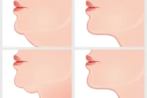 التطورات الحديثة في شد وتجميل الرقبة