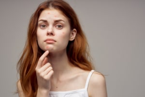 أنواع ندبات حب الشباب وأفضل ٧ طرق لعلاجها