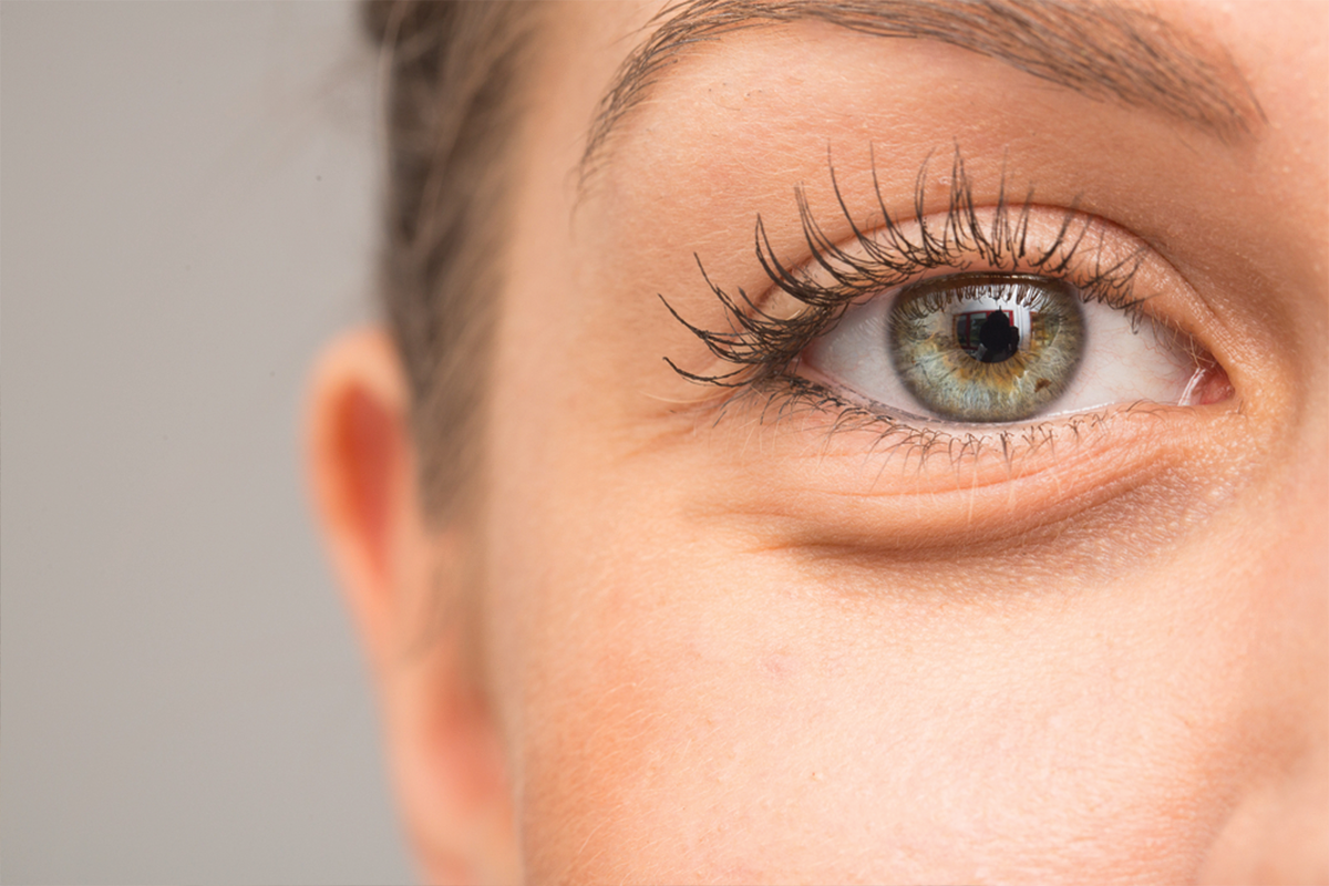 علاج الأكياس والإنتفاخات تحت العين
