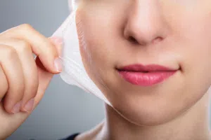 تقشير الميلادسي - MELADEEP PEEL