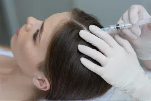حقن الإكسوزوم لتحفيز نمو الشعر