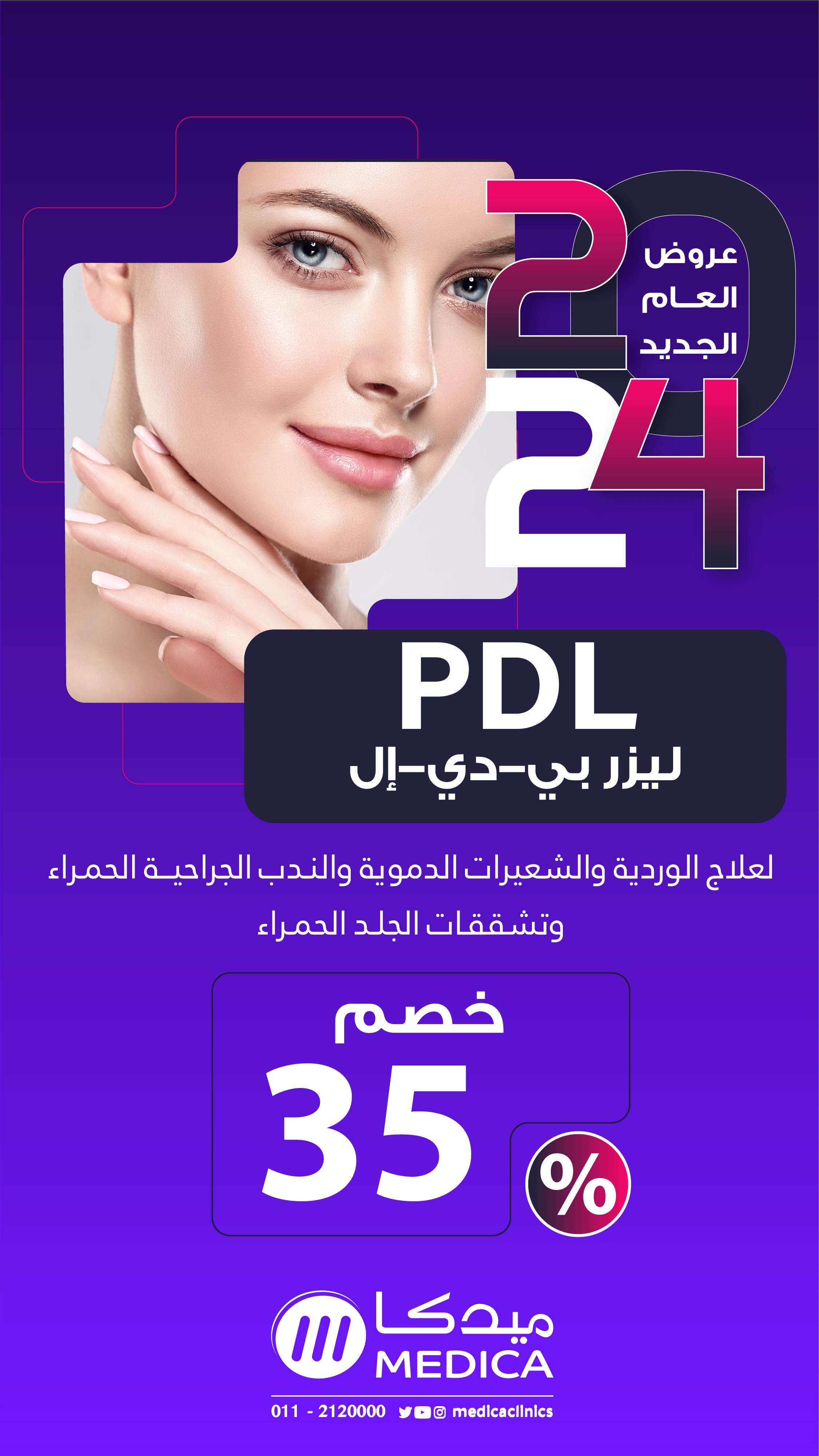 pdl
