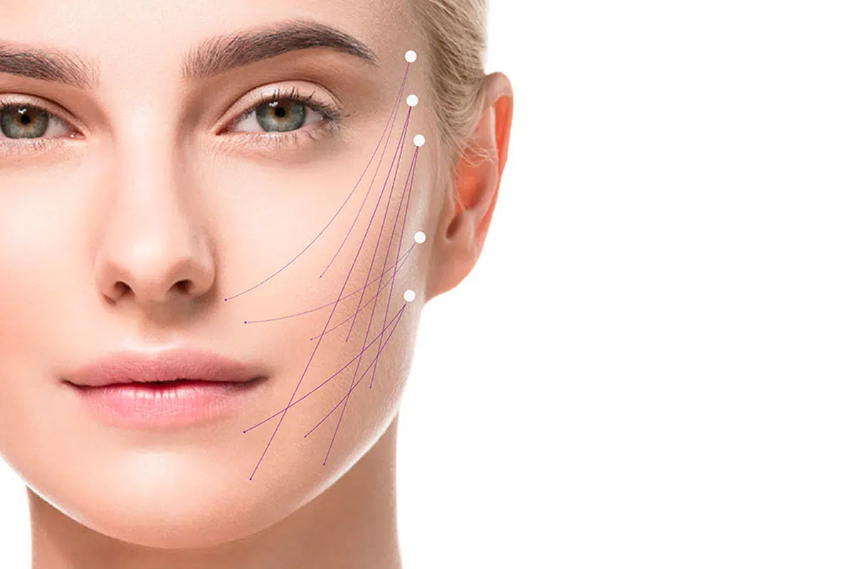 Endolift | Non-surgical Face Lift - عيادات ميدكا للجلدية والتجميل
