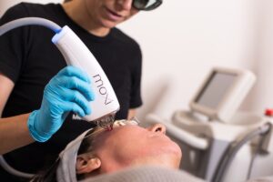 ليزر موكسي Moxi laser