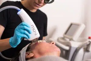 ليزر موكسي Moxi laser