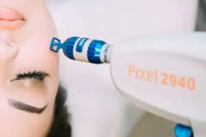 بيكسل ليزر Pixel Laser لتجديد البشرة
