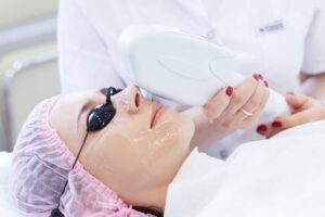 IPL Intense Pulsed Light