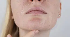 cimel peel