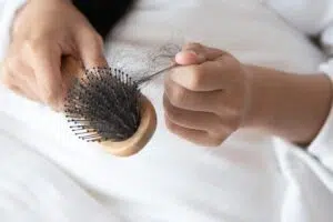 تساقط الشعر بعد الولادة