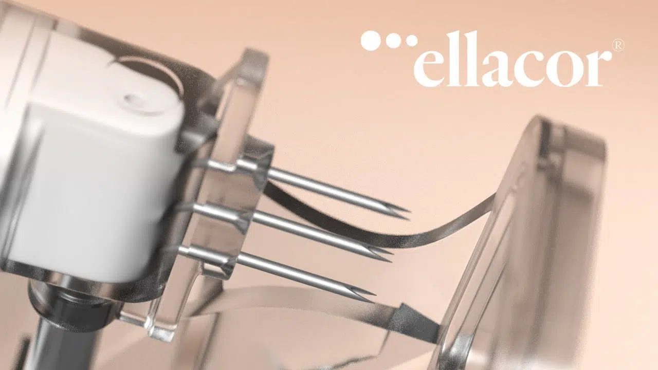 تقنية ايلاكور Ellacor لتجديد البشرة