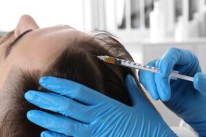 ابر المينوكسيديل لعلاج مشاكل تساقط الشعر