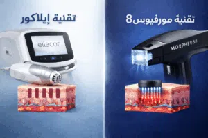 الفرق بين تقنية إيلاكور وتقنية مورفيوس8: أيهما أفضل لشد الجلد بدون جراحة