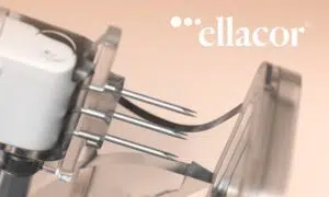 Ellacor Micro-Coring Treatment: A Breakthrough in Non-Surgical Skin Rejuvenation