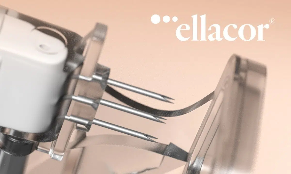 Ellacor Micro-Coring Treatment: A Breakthrough in Non-Surgical Skin Rejuvenation