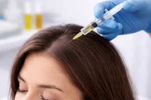 Exosmart Hair Treatment: Advanced Exosome Therapy for Hair Loss and Hair Regrowth